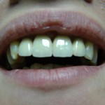 img_003