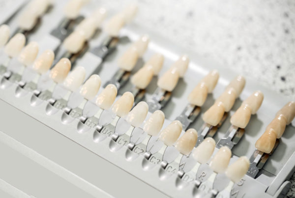 Veštačke zubne kosti